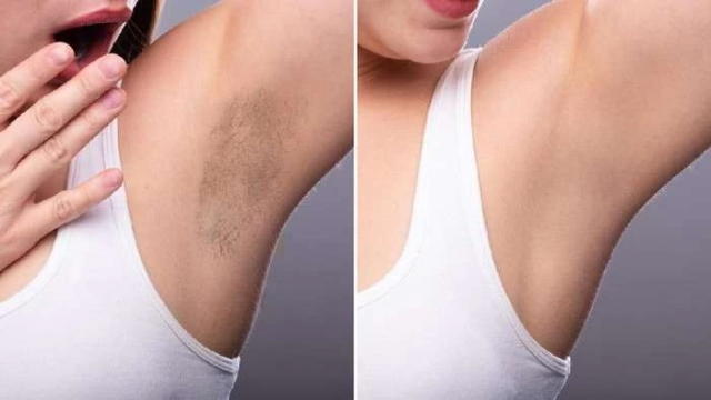 Tips Mudah Mencerahkan Ketiak Hitam Menjadi Cerah Secara Alami